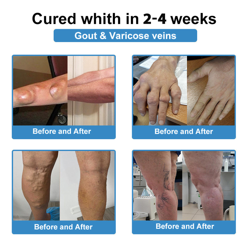 [New Year Special Offer] CureVivo® Pain Relief& Repair Lotion🏥For Muscle, Joint & Nerve Pain