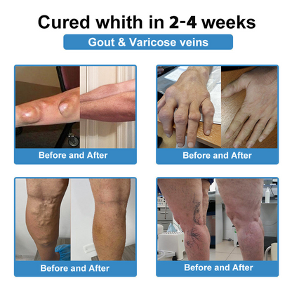 [New Year Special Offer] CureVivo® Pain Relief& Repair Lotion🏥For Muscle, Joint & Nerve Pain