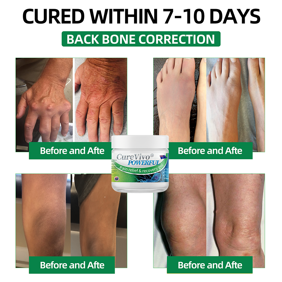 Official Store: ⚡CureVivo® Powerful pain relief&recovery gel(Painless, long-lasting relief, suitable for nerve pain, arthritis, varicose veins, and a wide range of orthopedic conditions)