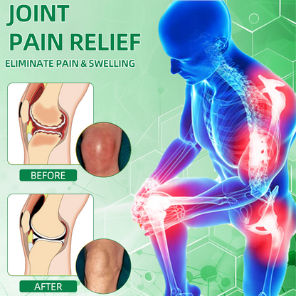 Official Store: ⚡CureVivo® Powerful pain relief&recovery gel(Painless, long-lasting relief, suitable for nerve pain, arthritis, varicose veins, and a wide range of orthopedic conditions)