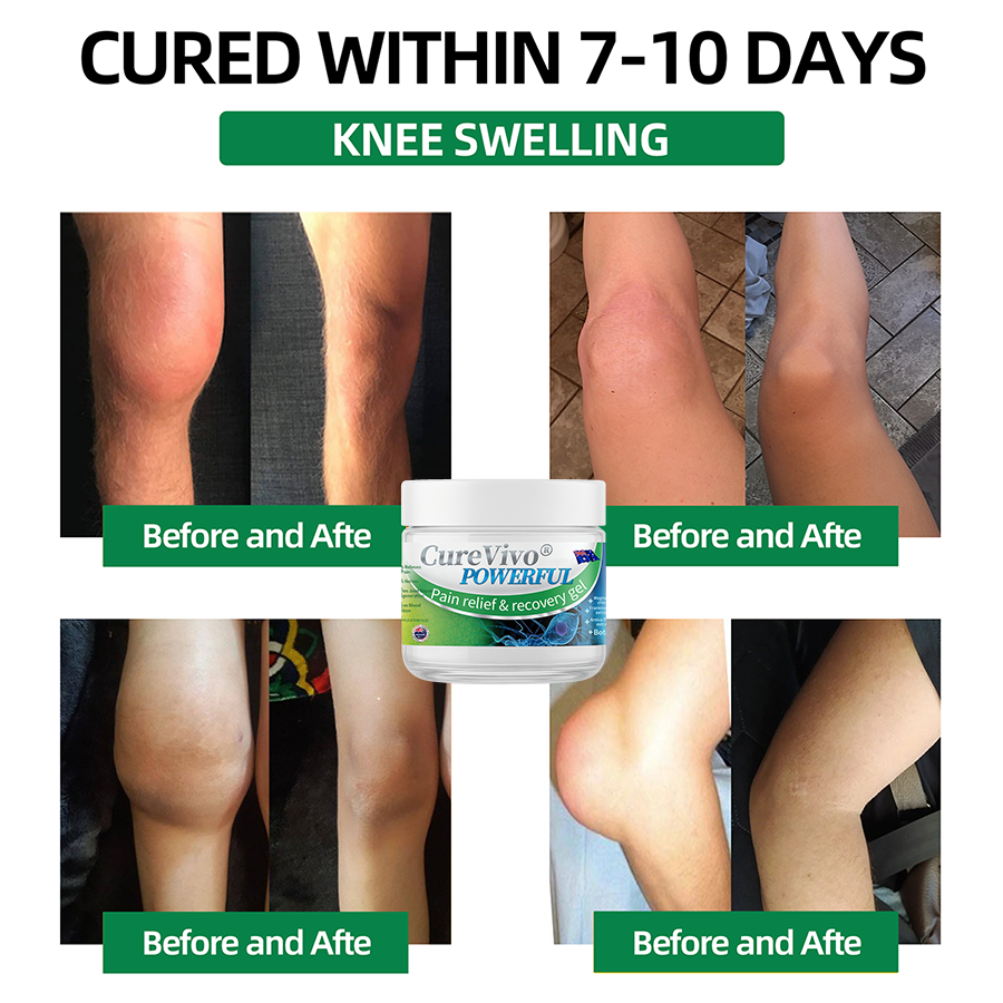 Official Store: ⚡CureVivo® Powerful pain relief&recovery gel(Painless, long-lasting relief, suitable for nerve pain, arthritis, varicose veins, and a wide range of orthopedic conditions)