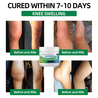 Official Store: ⚡CureVivo® Powerful pain relief&recovery gel(Painless, long-lasting relief, suitable for nerve pain, arthritis, varicose veins, and a wide range of orthopedic conditions)