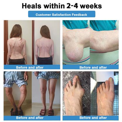 [New Year Special Offer] CureVivo® Pain Relief& Repair Lotion🏥For Muscle, Joint & Nerve Pain