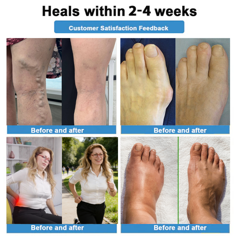 Healrize® 🍃4-in-1 Vein & Joint Nano Microneedle Advanced Therapy Patch🔥Instant Relief, Long-Term Results