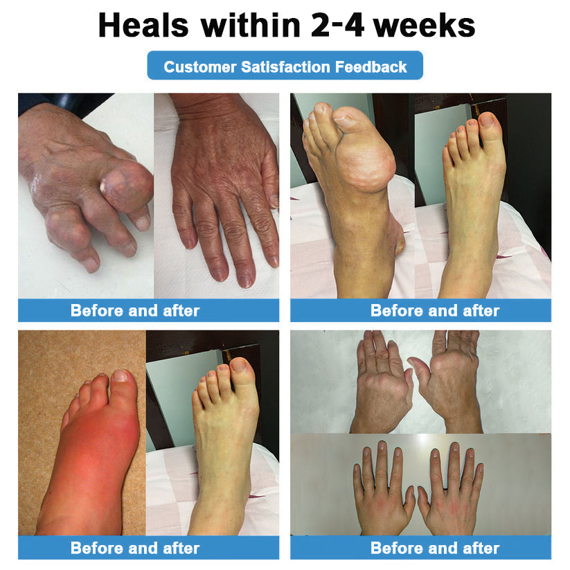 [New Year Special Offer] CureVivo® Pain Relief& Repair Lotion🏥For Muscle, Joint & Nerve Pain