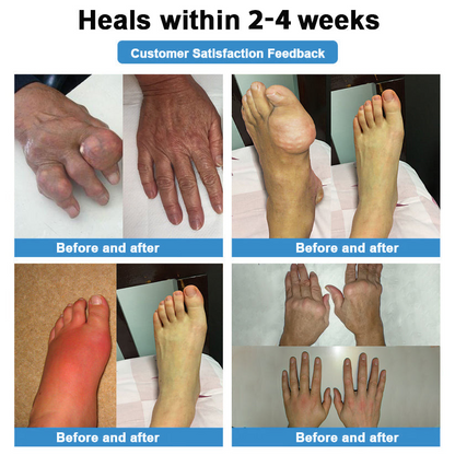[New Year Special Offer] CureVivo® Pain Relief& Repair Lotion🏥For Muscle, Joint & Nerve Pain