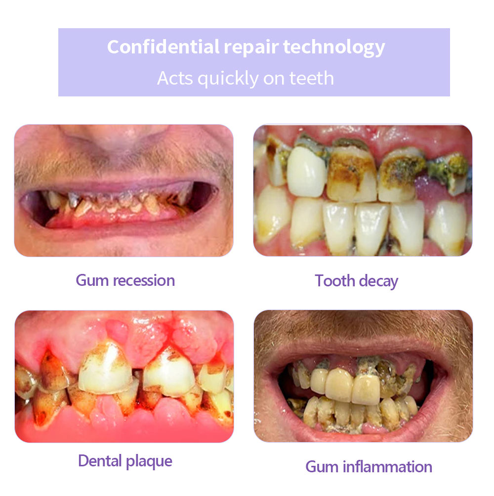 GarageLine® Teeth Restoration Mineral Powder🧑‍🔬(Suitable for cavities, tooth sensitivity, gum recession, oral inflammation, periodontal problems, and various dental and oral care needs.)