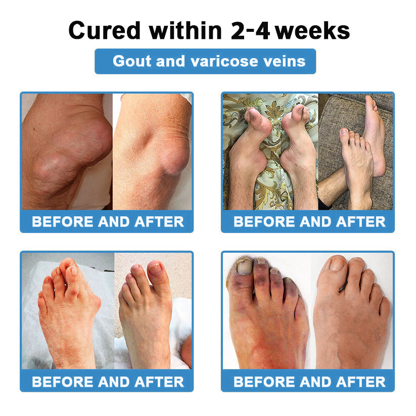 [New Year Special Offer] CureVivo® Pain Relief& Repair Lotion🏥For Muscle, Joint & Nerve Pain