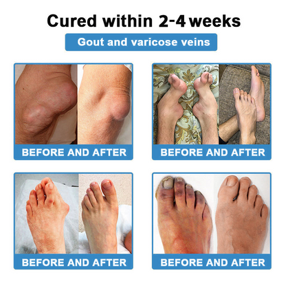 [New Year Special Offer] CureVivo® Pain Relief& Repair Lotion🏥For Muscle, Joint & Nerve Pain