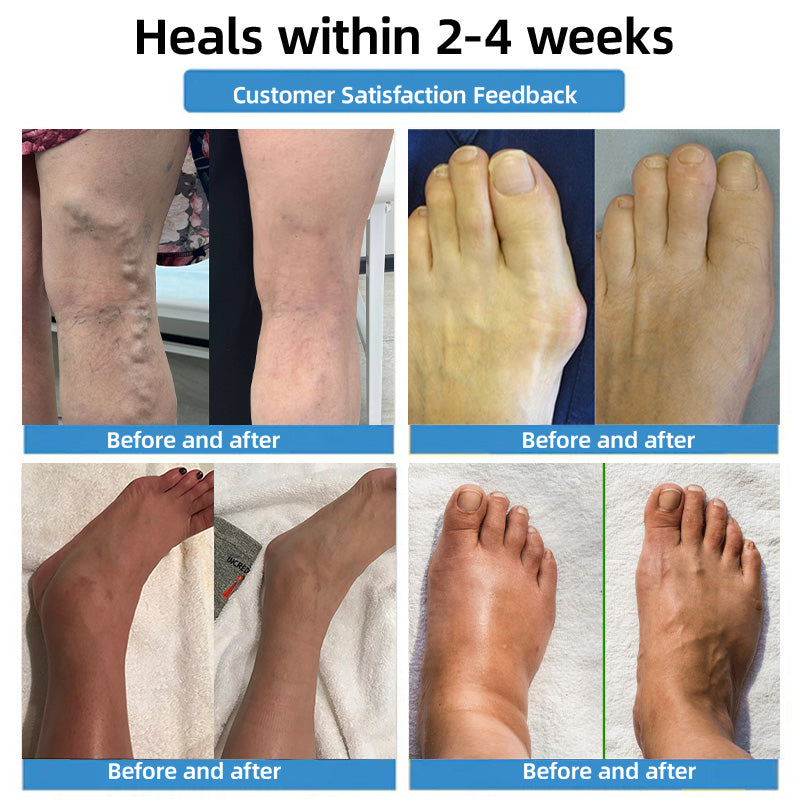 🇦🇺🧪✅𝐇𝐞𝐚𝐥𝐫𝐢𝐳𝐞® 𝐌𝐨𝐯𝐞𝐅𝐫𝐞𝐞 𝐕𝐢𝐭𝐚𝐥 𝐏𝐚𝐭𝐜𝐡 ⚡ 𝐓𝐫𝐚𝐜𝐞 𝐞𝐥𝐞𝐦𝐞𝐧𝐭𝐬 & 𝐡𝐞𝐫𝐛𝐚𝐥 𝐬𝐮𝐩𝐩𝐨𝐫𝐭 🌱 𝐃𝐢𝐚𝐛𝐞𝐭𝐞𝐬, 𝐯𝐚𝐫𝐢𝐜𝐨𝐬𝐞 𝐯𝐞𝐢𝐧𝐬, 𝐚𝐫𝐭𝐡𝐫𝐢𝐭𝐢𝐬, 𝐧𝐞𝐫𝐯𝐞 𝐩𝐚𝐢𝐧🪴🪴