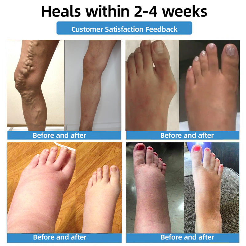 🇦🇺🧪✅𝐇𝐞𝐚𝐥𝐫𝐢𝐳𝐞® 𝐌𝐨𝐯𝐞𝐅𝐫𝐞𝐞 𝐕𝐢𝐭𝐚𝐥 𝐏𝐚𝐭𝐜𝐡 ⚡ 𝐓𝐫𝐚𝐜𝐞 𝐞𝐥𝐞𝐦𝐞𝐧𝐭𝐬 & 𝐡𝐞𝐫𝐛𝐚𝐥 𝐬𝐮𝐩𝐩𝐨𝐫𝐭 🌱 𝐃𝐢𝐚𝐛𝐞𝐭𝐞𝐬, 𝐯𝐚𝐫𝐢𝐜𝐨𝐬𝐞 𝐯𝐞𝐢𝐧𝐬, 𝐚𝐫𝐭𝐡𝐫𝐢𝐭𝐢𝐬, 𝐧𝐞𝐫𝐯𝐞 𝐩𝐚𝐢𝐧🪴🪴