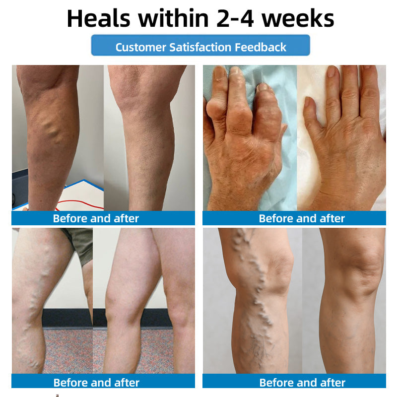 🇦🇺🧪✅𝐇𝐞𝐚𝐥𝐫𝐢𝐳𝐞® 𝐌𝐨𝐯𝐞𝐅𝐫𝐞𝐞 𝐕𝐢𝐭𝐚𝐥 𝐏𝐚𝐭𝐜𝐡 ⚡ 𝐓𝐫𝐚𝐜𝐞 𝐞𝐥𝐞𝐦𝐞𝐧𝐭𝐬 & 𝐡𝐞𝐫𝐛𝐚𝐥 𝐬𝐮𝐩𝐩𝐨𝐫𝐭 🌱 𝐃𝐢𝐚𝐛𝐞𝐭𝐞𝐬, 𝐯𝐚𝐫𝐢𝐜𝐨𝐬𝐞 𝐯𝐞𝐢𝐧𝐬, 𝐚𝐫𝐭𝐡𝐫𝐢𝐭𝐢𝐬, 𝐧𝐞𝐫𝐯𝐞 𝐩𝐚𝐢𝐧🪴🪴