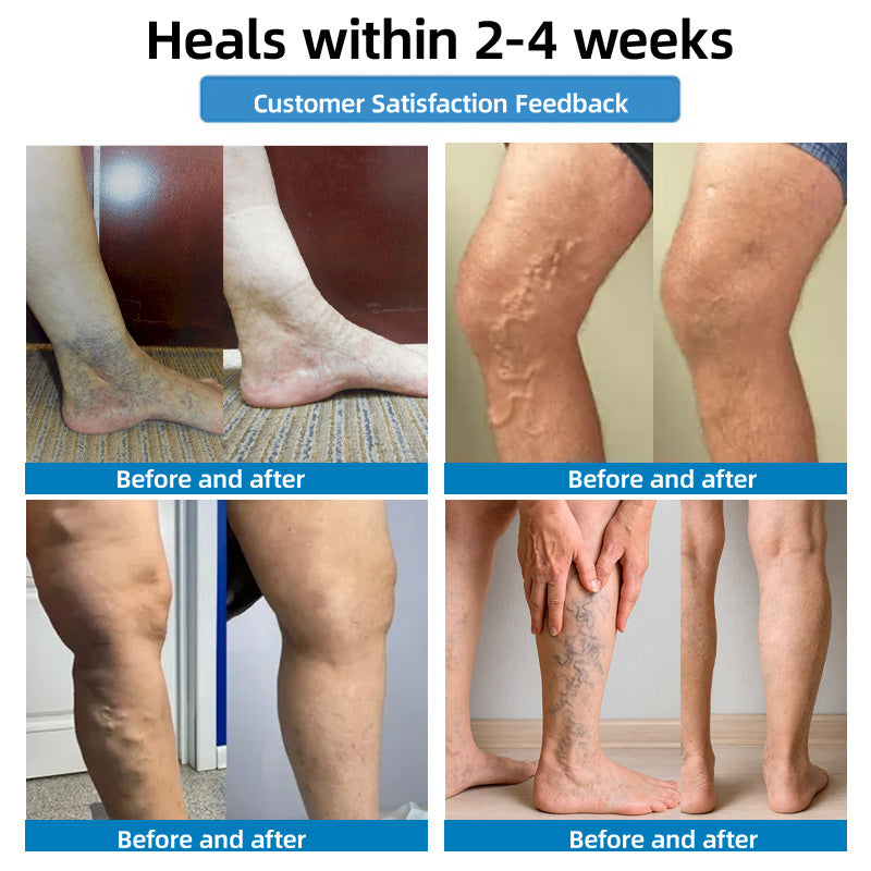 🇦🇺🧪✅𝐇𝐞𝐚𝐥𝐫𝐢𝐳𝐞® 𝐌𝐨𝐯𝐞𝐅𝐫𝐞𝐞 𝐕𝐢𝐭𝐚𝐥 𝐏𝐚𝐭𝐜𝐡 ⚡ 𝐓𝐫𝐚𝐜𝐞 𝐞𝐥𝐞𝐦𝐞𝐧𝐭𝐬 & 𝐡𝐞𝐫𝐛𝐚𝐥 𝐬𝐮𝐩𝐩𝐨𝐫𝐭 🌱 𝐃𝐢𝐚𝐛𝐞𝐭𝐞𝐬, 𝐯𝐚𝐫𝐢𝐜𝐨𝐬𝐞 𝐯𝐞𝐢𝐧𝐬, 𝐚𝐫𝐭𝐡𝐫𝐢𝐭𝐢𝐬, 𝐧𝐞𝐫𝐯𝐞 𝐩𝐚𝐢𝐧🪴🪴