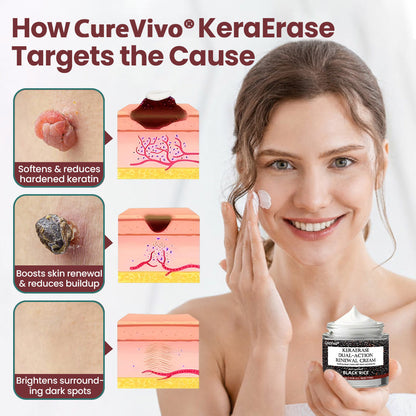 CureVivo® Enjoy 50% OFF for adding the second one