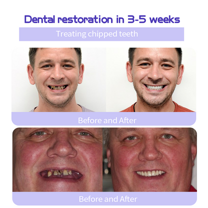 GarageLine® Teeth Restoration Mineral Powder🧑‍🔬(Suitable for cavities, tooth sensitivity, gum recession, oral inflammation, periodontal problems, and various dental and oral care needs.)