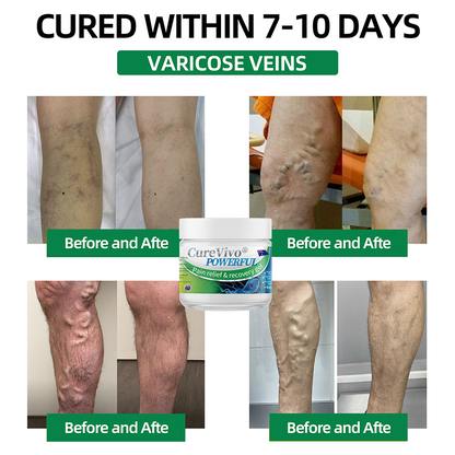 Official Store: ⚡CureVivo® Powerful pain relief&recovery gel(Painless, long-lasting relief, suitable for nerve pain, arthritis, varicose veins, and a wide range of orthopedic conditions)