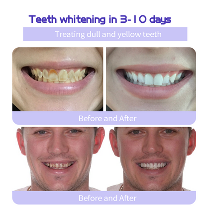 GarageLine® Teeth Restoration Mineral Powder🧑‍🔬(Suitable for cavities, tooth sensitivity, gum recession, oral inflammation, periodontal problems, and various dental and oral care needs.)
