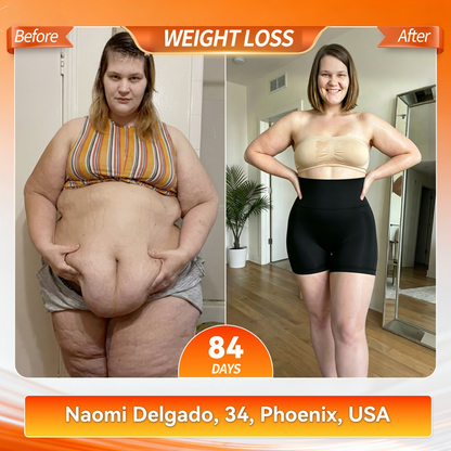 Au 𝐎𝐟𝐟𝐢𝐜𝐢𝐚𝐥 𝐁𝐫𝐚𝐧𝐝 𝐒𝐭𝐨𝐫𝐞 | 🍔 LUCKYSONG® 2026 8-in-1  Thermo Fat-Burning & Butt-Lifting Yoga Slimming Pants