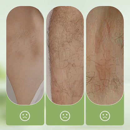 ⏳Hudros ® Limited-time 50% off⏰💥Large-size hair removal cream Gentle and non-irritating hair removal cream set (hair removal cream + razor)🎁