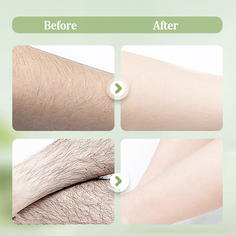 ⏳Hudros ® Limited-time 50% off⏰💥Large-size hair removal cream Gentle and non-irritating hair removal cream set (hair removal cream + razor)🎁